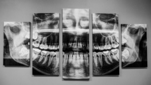 framed picture of digital x rays of an orthodontic patient